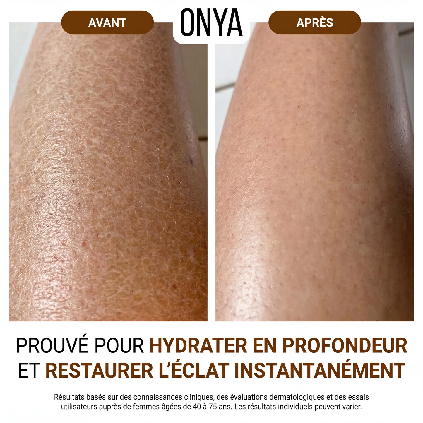 ONYA™ Huile Raffermissante Corporelle