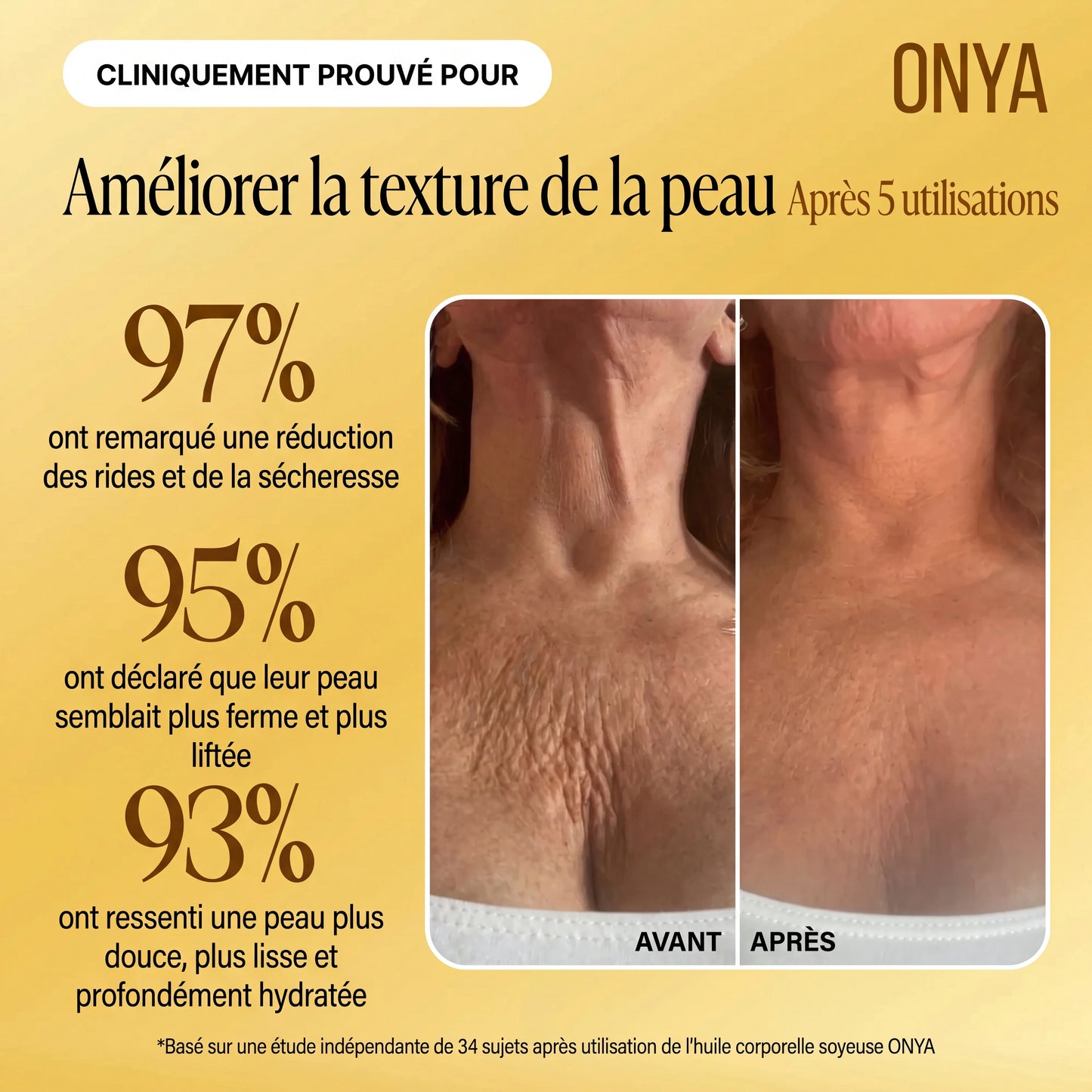 ONYA™ Huile Raffermissante Corporelle