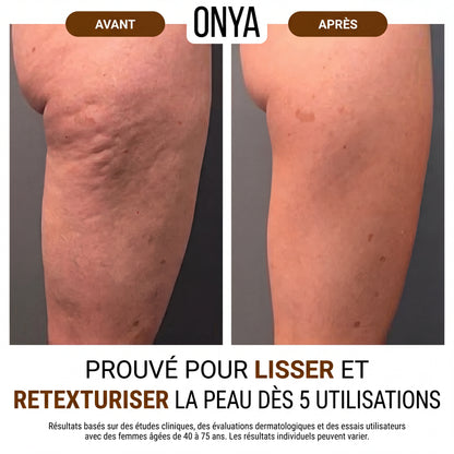 ONYA™ Huile Raffermissante Corporelle