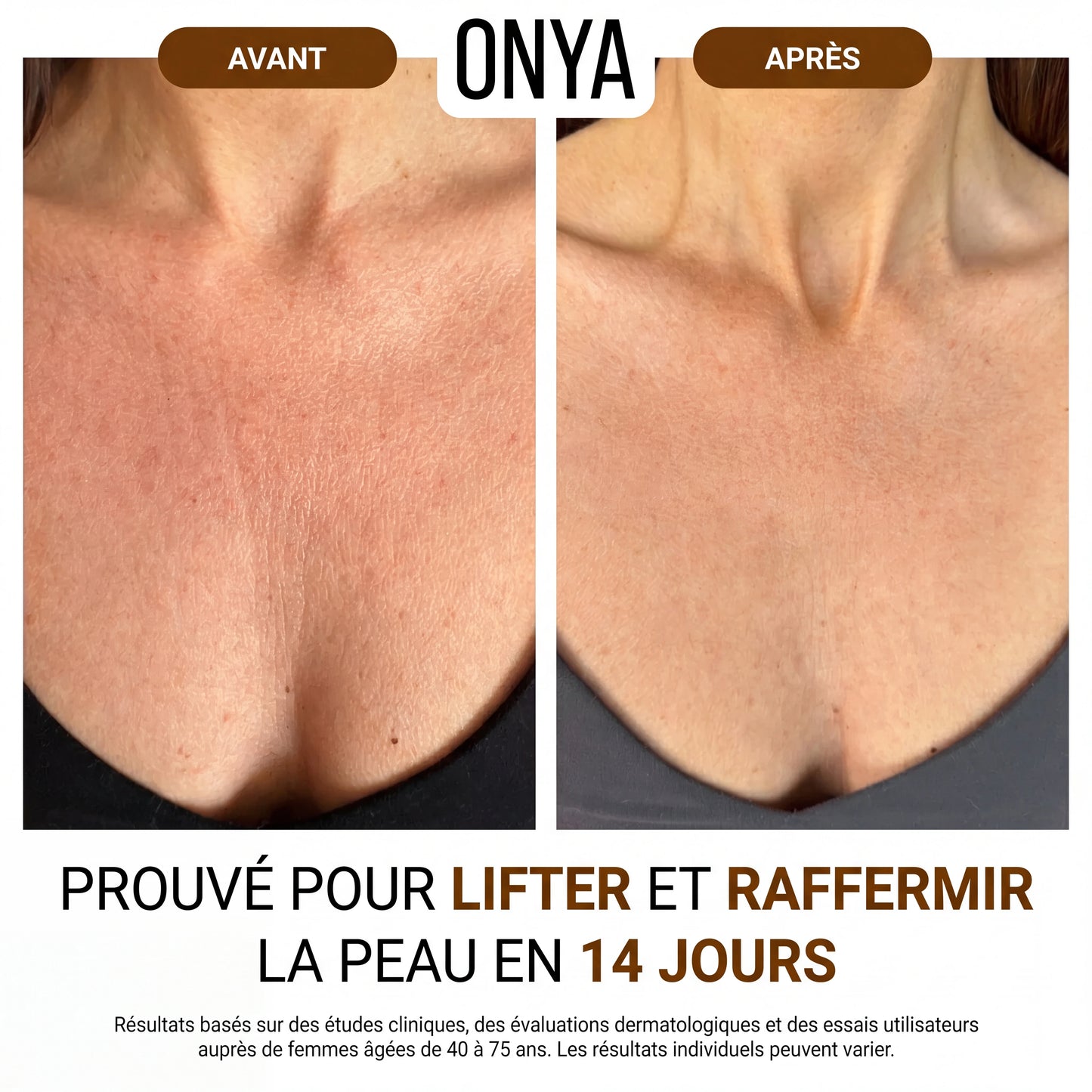 ONYA™ Huile Raffermissante Corporelle