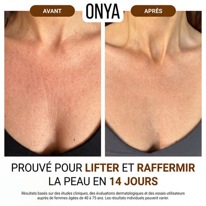 ONYA™ Huile Raffermissante Corporelle